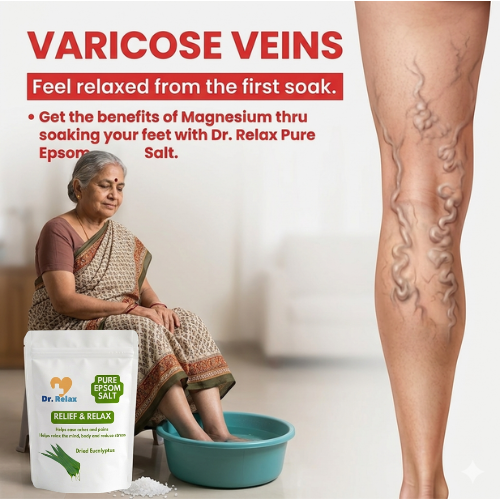 Varicose Veins Home Remedy — Natural Relief for Leg Pain & Swelling India